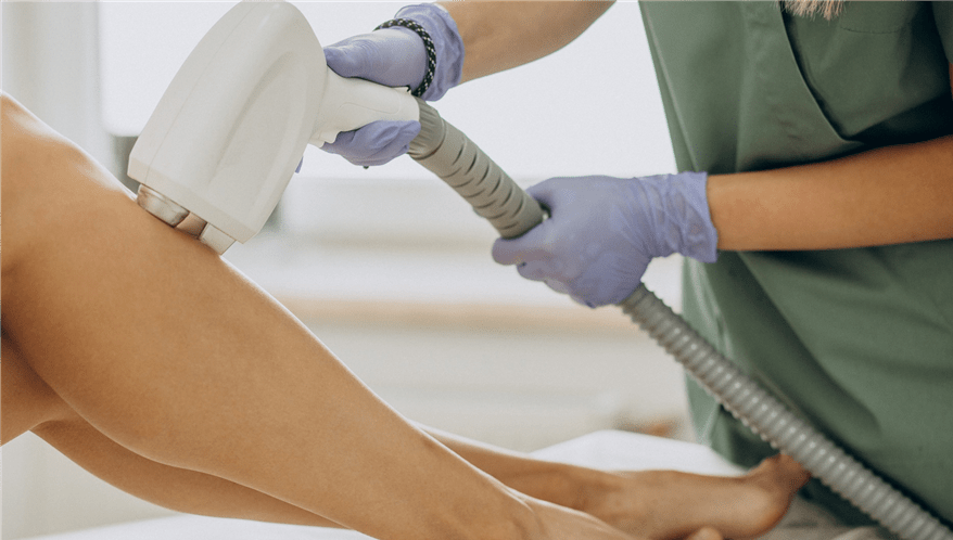 Profissional realizando sessão de depilação a laser